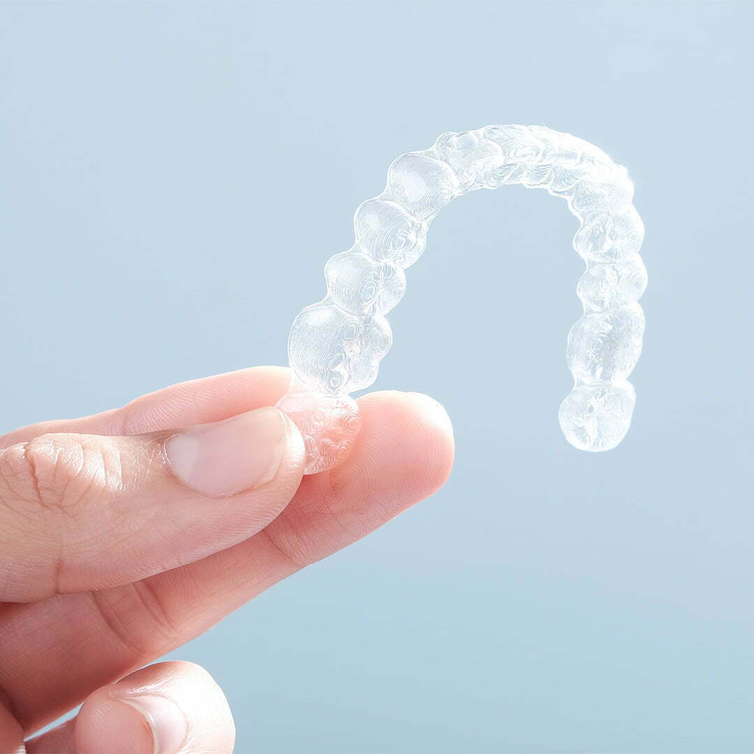 clear-braces-3