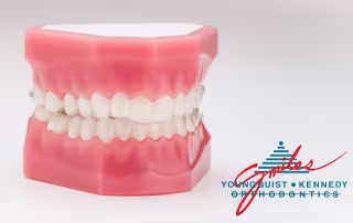clear aligners